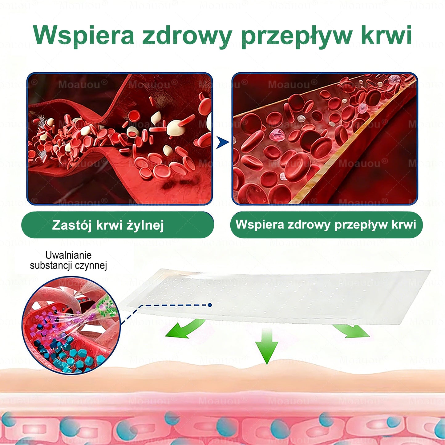 Moauou® Mikronakłuwający Plaster ⚡ Natychmiastowa ulga, długotrwałe efekty – WIELKA PROMOCJA!